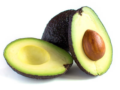 [41] AVOCAT